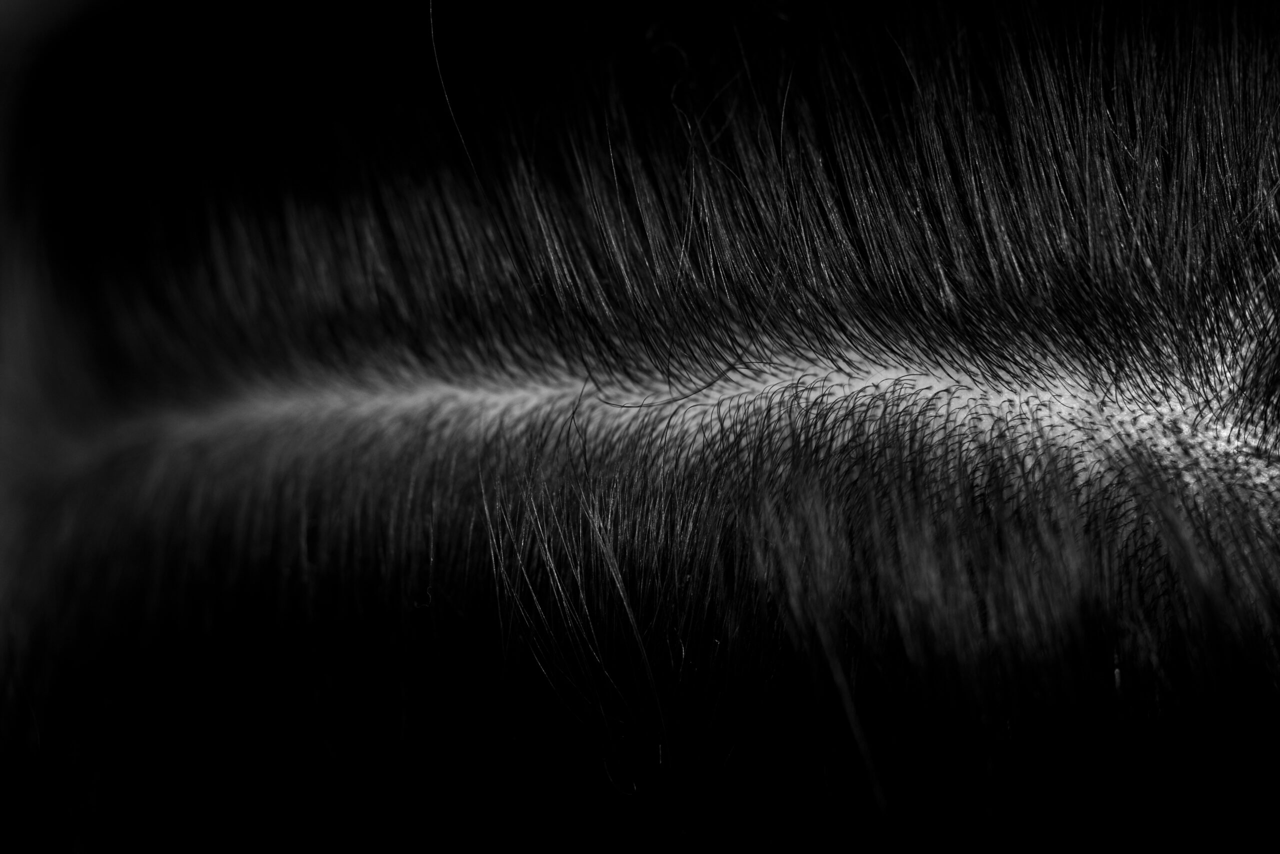 "Diagram showing hair follicle damage leading to hair loss"